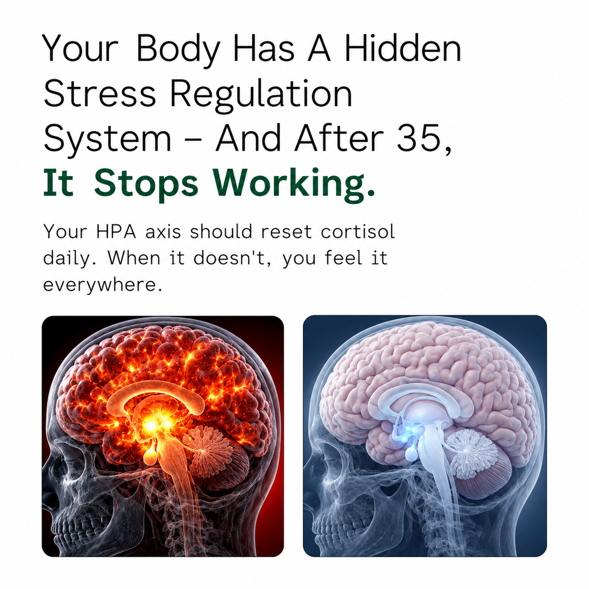 Rhodiola Rosea Capsules (400mg)